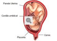 Ilustração: Placenta
